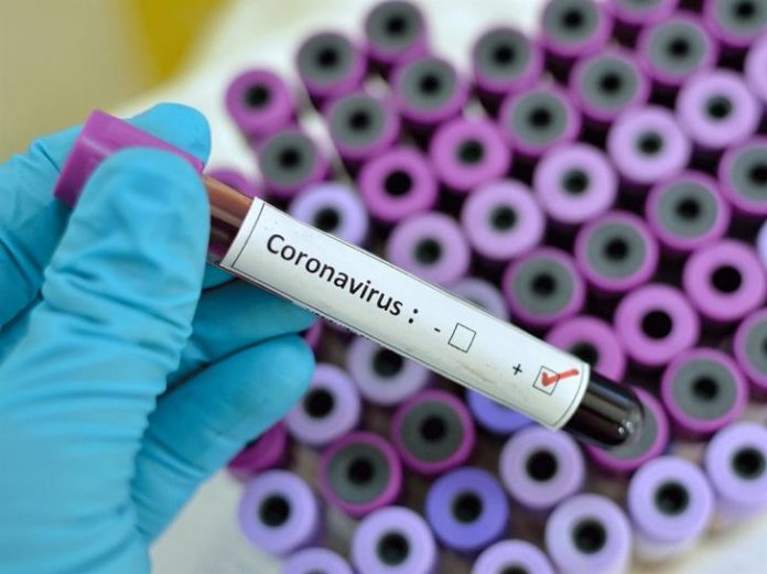 coronavirus-positive
